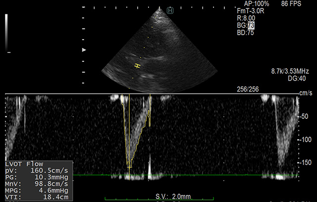 心臓の状況を超音波検査でしっかり把握