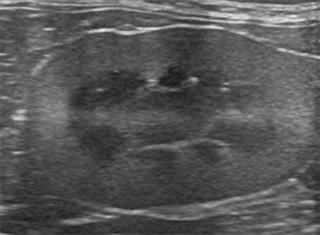 腎臓病の原因追求のための細かな検査