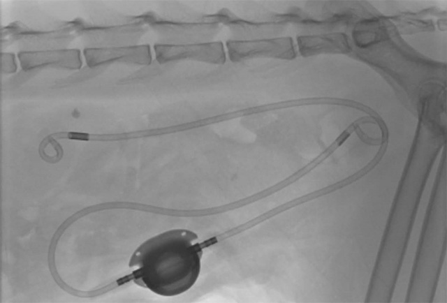 マイクロサージェリーやSUBなどの外科手術の実績