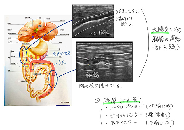 検査結果の説明・治療方針のご相談